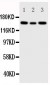 Anti-IGF1R Antibody