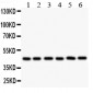 Anti-CD25/IL-2sR alpha Antibody