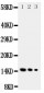 Anti-IL-3 Antibody