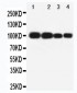 Anti-MAG Antibody