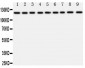 Anti-TRPC3 Antibody