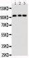 Anti-TRPC6 Antibody