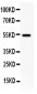 Anti-VIP Receptor 1 Antibody