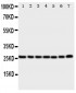 Anti-CACYBP Antibody