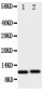 Anti-CXCL1 Antibody