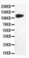 Anti-DPYD Antibody