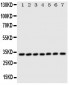 Anti-DCI Antibody