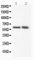 Anti-FMO3 Antibody