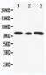 Anti-Gli3 Antibody