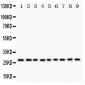 Anti-Kallikrein-6 Antibody