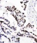 Anti-MCM6 Antibody