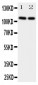 Anti-Neuropilin-2 Antibody