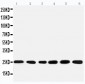 Anti-SNRPN Antibody