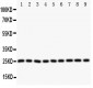 Anti-SOD2 Antibody