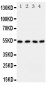 Anti-SPTLC1 Antibody