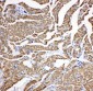 Anti-cardiac Troponin C Antibody