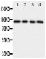 Anti-AHR Antibody