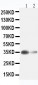 Anti-liver Arginase Antibody