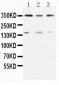 Anti-ATM Antibody