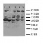 Anti-ATM Antibody