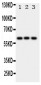 Anti-HEXA Antibody