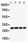 Anti-HLA DMB Antibody