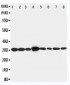 Anti-LASP1 Antibody