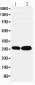 Anti-LASP1 Antibody