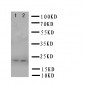 Anti-PRNP Antibody