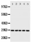 Anti-14-3-3 Sigma Antibody