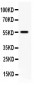 Anti-TFPI Antibody