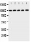 Anti-CBL Antibody