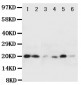 Anti-HSPB2 Antibody