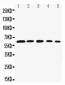 Anti-Rel B Antibody