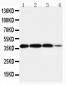 Anti-Arg2 Antibody
