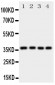 Anti-Bmi1 Antibody