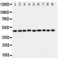 Anti-E2F2 Antibody