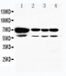 Anti-HSPA2 Antibody
