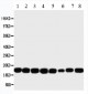 Anti-NM23A Antibody