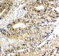 Anti-NME2 Antibody