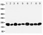 Anti-NME2 Antibody