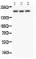 Anti-NOTCH4 Antibody