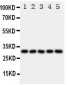 Anti-LOX-1/OLR1 Antibody