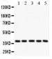 Anti-LOX-1/OLR1 Antibody