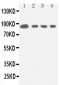 Anti-STAT5a Antibody