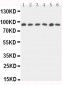 Anti-STAT5b Antibody