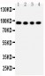 Anti-ADAM17 Antibody