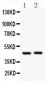 Anti-Beta Arrestin 2 Antibody