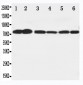 Anti-B Raf Antibody