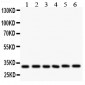 Anti-Caspase 3 Antibody